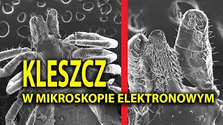 Zoom na KLESZCZA w Mikroskopie Elektronowym (SEM)