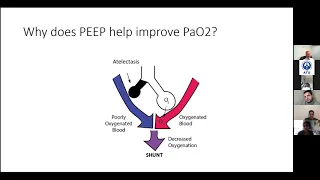 Virtual Boot Camp: Ventilator Management Breakout Session