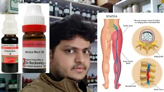 homeopathic medicine for treatment of sciatica?? explain!