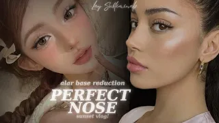 ALAR BASE REDUCTION # how to get rid of bulbous, wide nose? [mini sunset vlog 🌅]