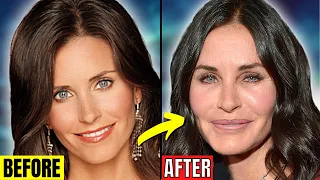 6 Celebrity Surgeries Gone Wrong