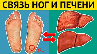 Как ноги сигнализируют о БОЛЕЗНЯХ ПЕЧЕНИ? Проверьте свои ноги!