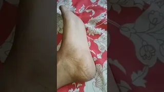 Rough feet