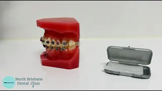 How to use orthodontic wax to stop rubbing