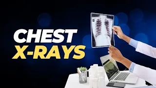 Chest X-rays Atlas