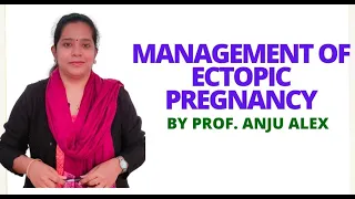 Management of Ectopic Pregnancy II B Sc Nursing 4th Year II Gynecology II Anju Madam II