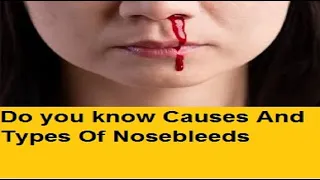 Do you know Causes And Types Of Nosebleeds