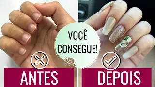 6 DICAS PARA PARAR DE ROER UNHAS DE UMA VEZ POR TODAS!