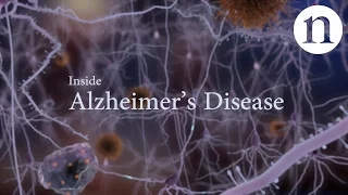 Inside Alzheimer’s disease