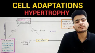 Hypertrophy | Cell Adaptations (1/3) | General Pathology | EOMS