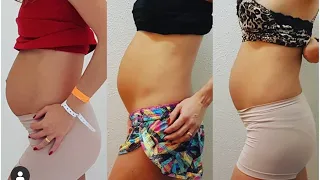 Meu corpo no pós-parto #shorts