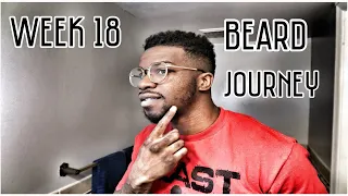 SM’s Minoxidil Beard Journey (Week 18) How to grow a beard