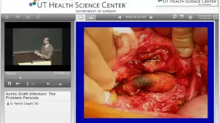 GR 02 11 08   Aortic Graft Infections The Problem Persists   Dr  G  Patrick Clagett