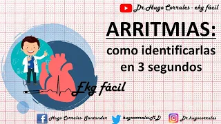 ARRITMIAS CARDÍACAS : como identificarlas en 3 segundos.