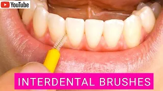 How to Use Interdental Brushes Correctly. Top Tips!