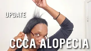 CCCA Alopecia Hair & Scalp Care | Quick Update #alopecia