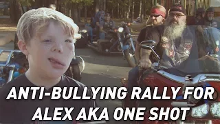 Bikers rally behind boy bullied because of rare condition