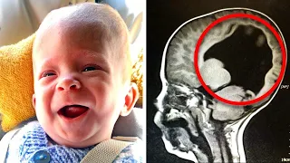 Kind ohne Gehirn geboren! Als der Arzt hinsieht, muss er schreien!