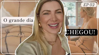 Fiz a Cirurgia Tripla: Lipoaspiração 360 + Abdominoplastia + Mastopexia com Prótese