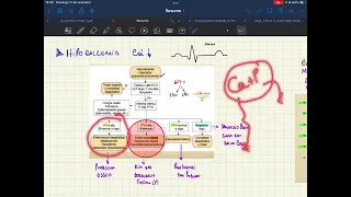 Bioquímica Clínica - Distúrbios do Cálcio