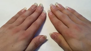 Fingernail Time Lapse (13 weeks without clipping)