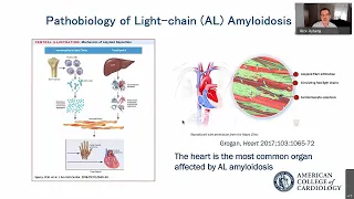 Cardiac Amyloidosis: Quick Tips on Nomenclature and Epidemiology