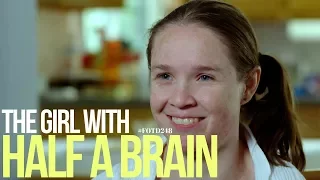 The girl with half a brain - #FOTD248