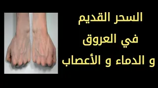 رقية السحر القديم المنتشر في الدماء و العروق و الأعصاب و كل الجسد