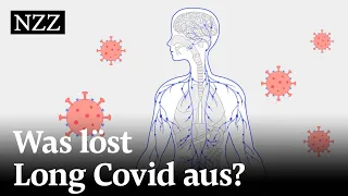 Long Covid: Was steckt hinter den chronischen Corona-Symptomen?