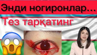 ШОК ХАБАР. НОГИРОНЛАР нега бундай қийналмоқда