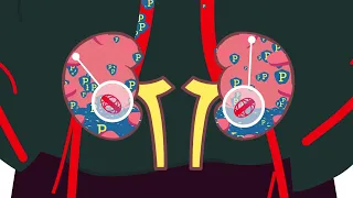 How doctors diagnose and treat C3G and IC-MPGN | Rare Disease | American Kidney Fund