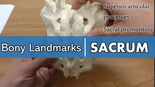 Bony Landmarks of the Sacrum