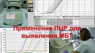 Современные технологии для микробиологической диагностики лекарственно-устойчивого туберкулеза