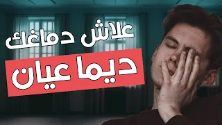 علاش دماغك ديما عيان