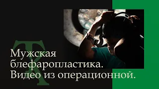 Видео полного хода операции по блефаропластике  КОНТЕНТ 18+