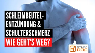 Schleimbeutelentzündung & Schulterschmerz - Wie geht's weg?