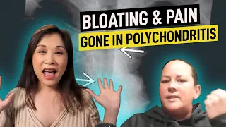 Bloating & Pain Gone in Polychondritis - Maggie Yu MD IFMCP