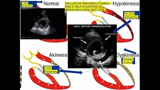 1 Test your skill ECHO   WMA basic echo