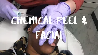 GETTING A FACIAL & CHEMICAL PEEL l VLOGMAS DAY 12