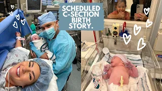 Scheduled C section birth story