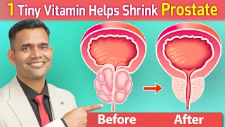 1 Tiny Vitamin Helps Shrink Prostate | Vitamin To Shrink Enlarged Prostate - Dr. Vivek Joshi