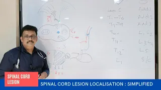 Neurological Localisation in Spinal Lesions || Spinal Lesions Localisation