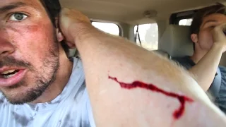 Attacked By A Scooter!!?