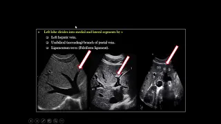 How To Liver Ultrasound  -Dr. Ismail Sayed Ismail  -Part 2