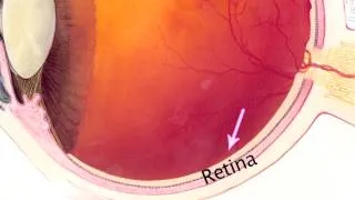 Glaucoma - Advancements in Research