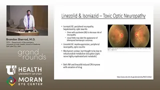 Ophthalmology Grand Rounds 2019- Part 1 of 3