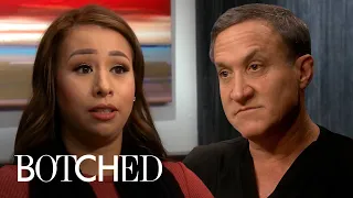 4 Botched Mommy Makeovers, Made Over! | E!