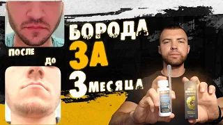 Лосьон для бороды минокс 5% Результаты До и После / Выпуск 12