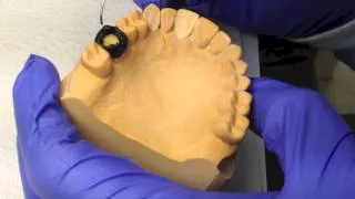 Occlusion Laboratory Video Guides Video 5 Waxing 3,6 and 8