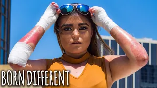 The 20-Year-Old With Butterfly Skin | BORN DIFFERENT